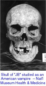 Skull studied as potential American vampire